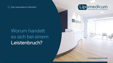 Worum handelt es sich bei einem Leistenbruch?